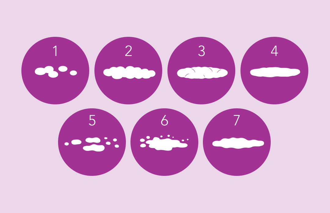 <p>Bristol Stool Chart</p>